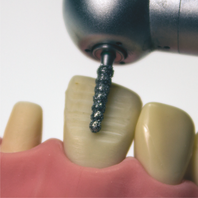 04. Алмазный бор семейства Редусер